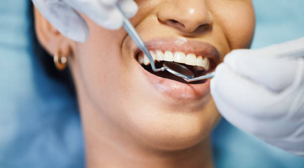 Best Emergency Dentist for Lost Fillings or Crowns in Northglenn, CO